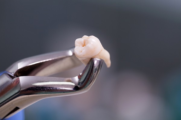 Perth dentist removing tooth