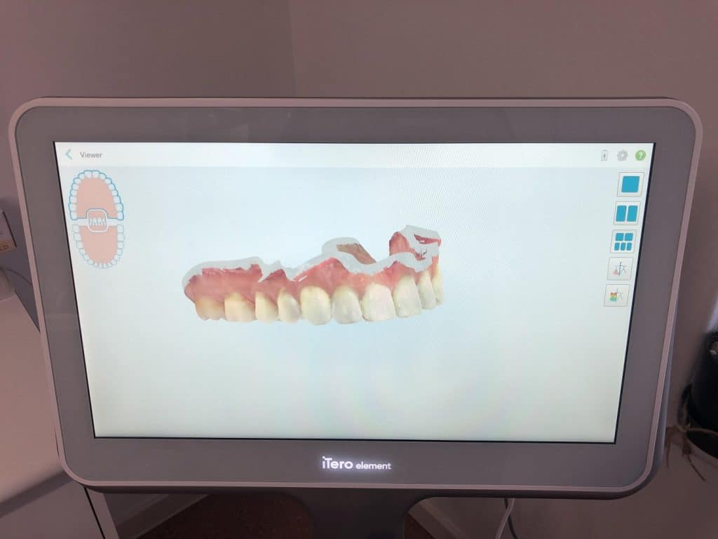 Dental Scan