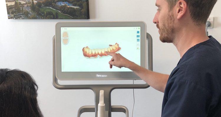 iTero Element 2 dental scanner