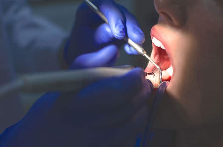 dentist performing a procedure