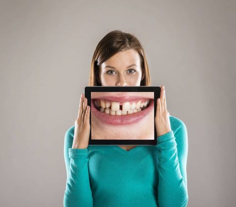 lady with image of teeth