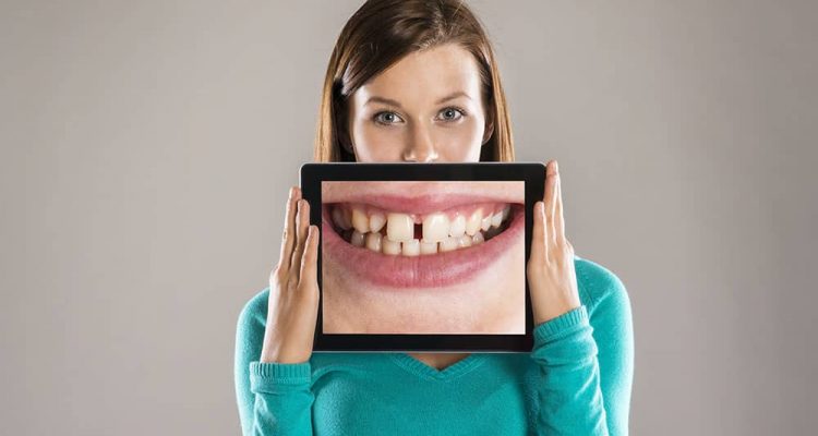 lady with image of teeth