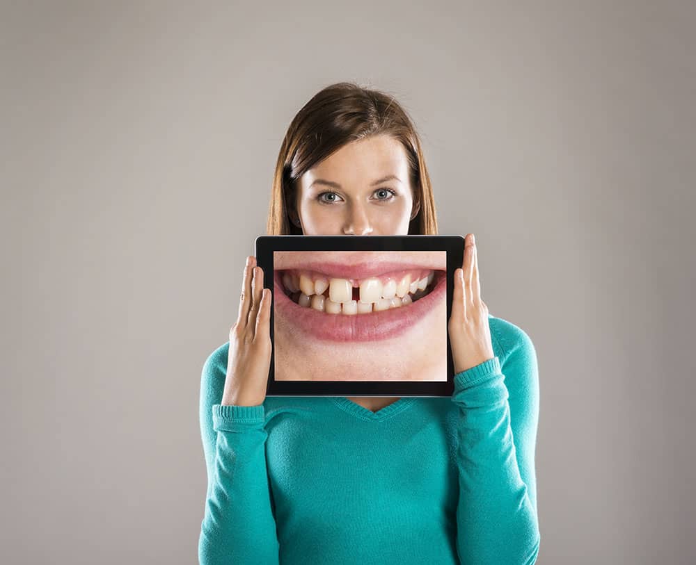 lady with image of teeth