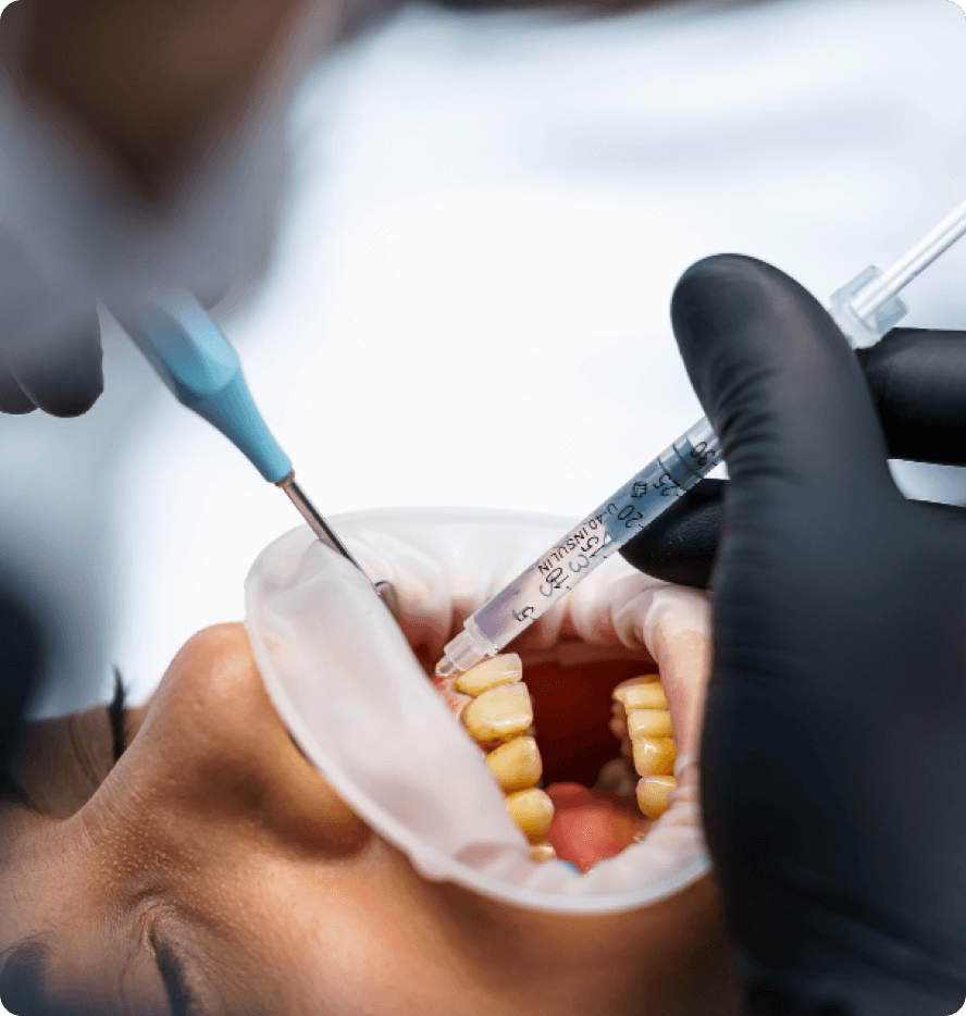 about sedation dentistry