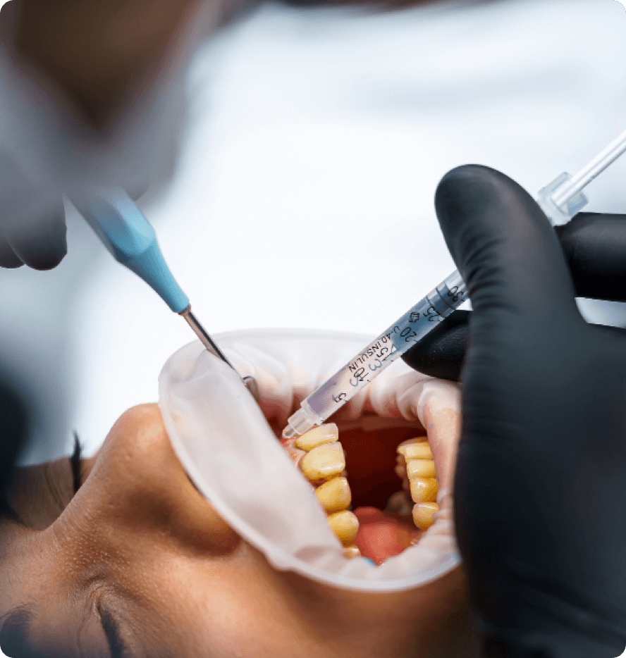 about-sedation-dentistry about sedation dentistry