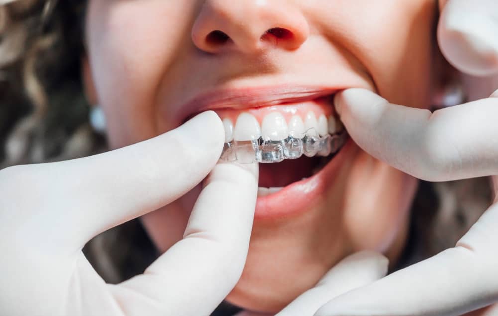 See your dentist regularly when wearing Invisalign trays.