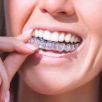 Aftercare is important for all orthodontic treatments, including Invisalign.