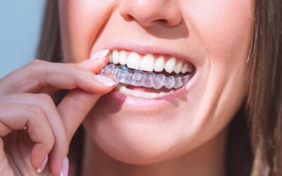 Aftercare is important for all orthodontic treatments, including Invisalign.