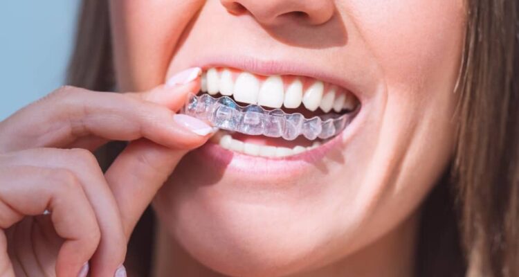 Aftercare is important for all orthodontic treatments, including Invisalign.