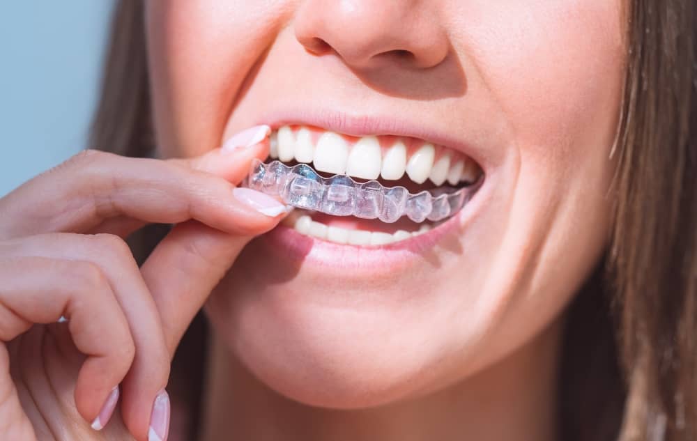 Aftercare is important for all orthodontic treatments, including Invisalign.