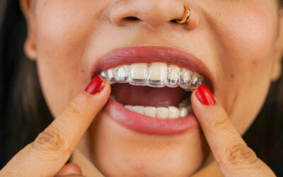 women inserting invisalign
