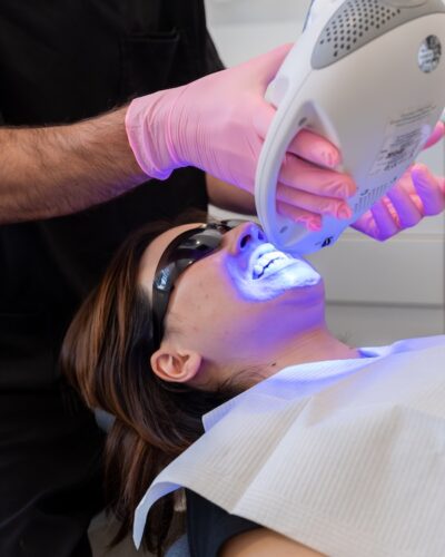 teeth-white-perth professional teeth whitening with fluoride machine in perth